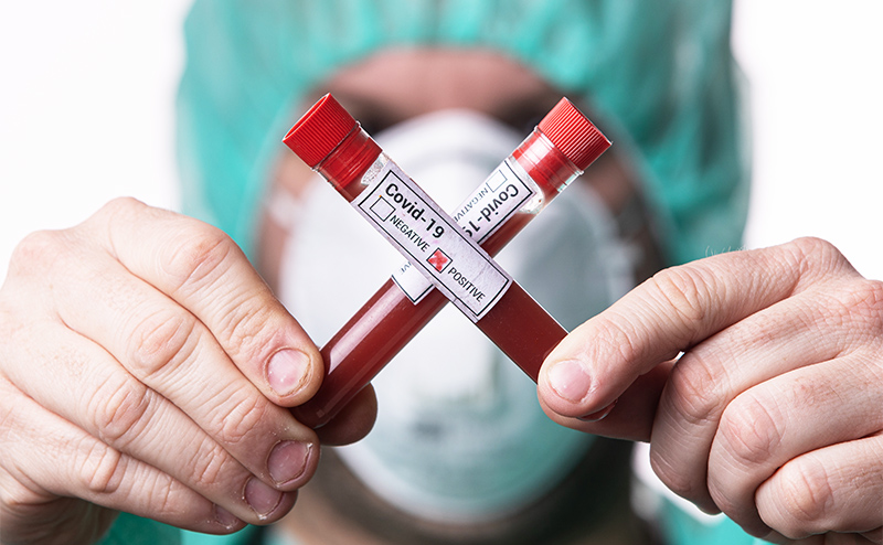 Медики доказали связь группы крови с COVID-19 Медики доказали связь группы крови с COVID-19