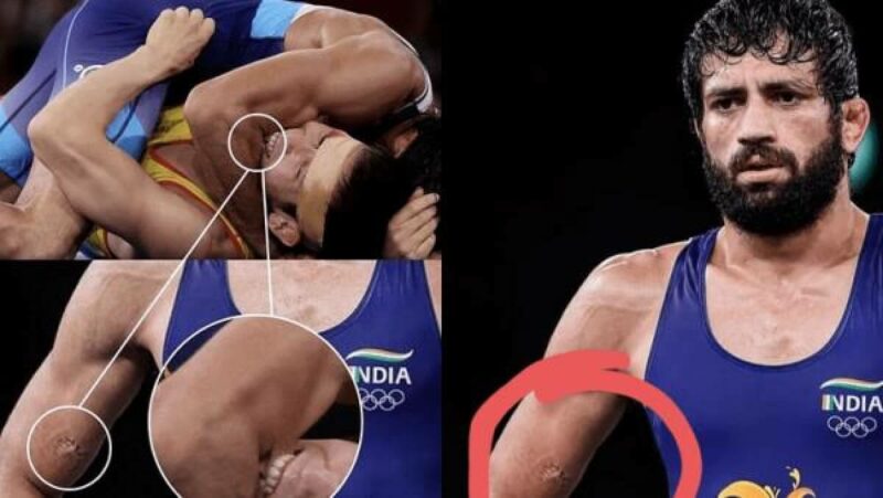 "Вирус Тайсона" на Олимпиаде: зачем спортсмены кусают своих соперников? "Вирус Тайсона" на Олимпиаде: зачем спортсмены кусают своих соперников?