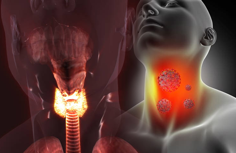 Диагноз в голосе: искусственный интеллект научился распознавать рак гортани искусственный интеллект научился распознавать рак гортани